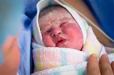 Újszülött bőrének fejlődése és a vernix caseosa