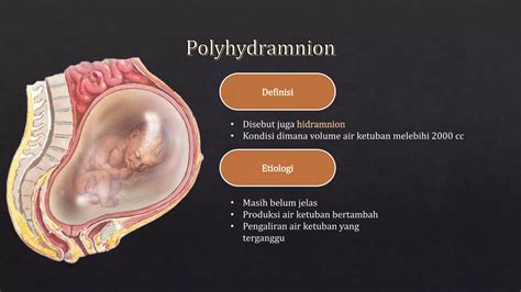 Polyhydramnion ultrahangképe