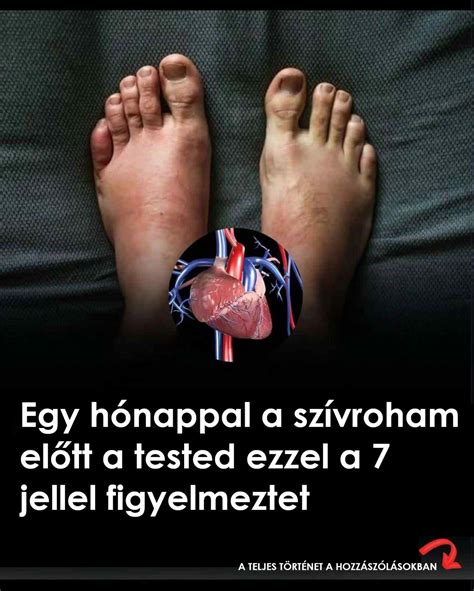 A szívritmuszavar figyelmeztető jelei
