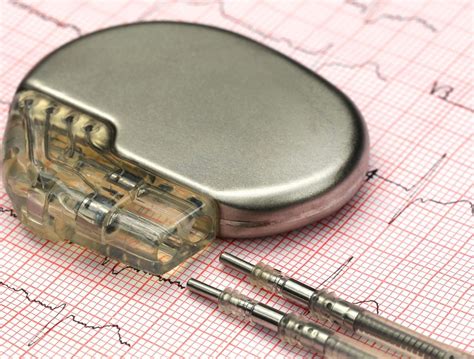 Pacemaker beültetés