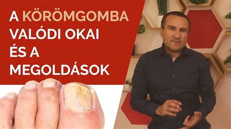 A körömgomba kialakulásának okai és terjedése