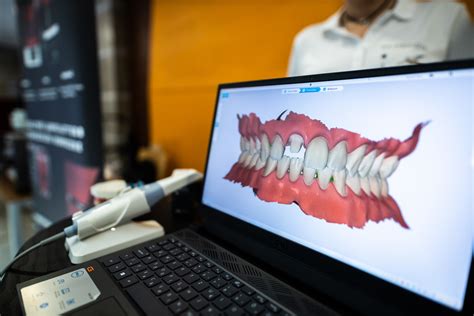 digitális fogászati tervezés folyamatábrája