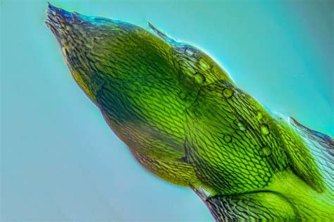 Páfrányszerű alakzatok a nyálban mikroszkóp alatt