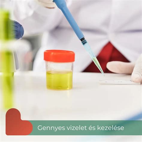 illusztráció a vizelet koncentrációjáról