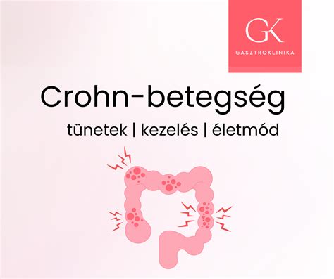Magzati hemolitikus betegség tünetei