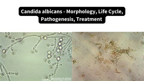 Candida albicans mikroszkóp alatt