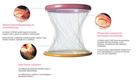 Orvosi okok, amelyek császármetszéshez vezethetnek