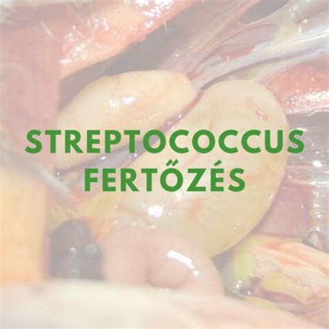 higiénia streptococcus fertőzés megelőzése