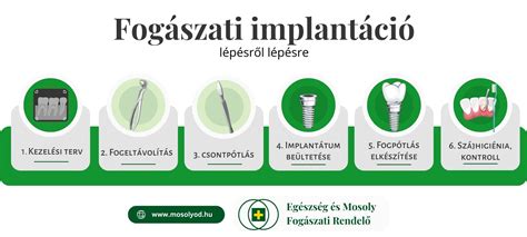 Az inszemináció menete lépésről lépésre