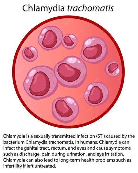A Chlamydia trachomatis baktérium