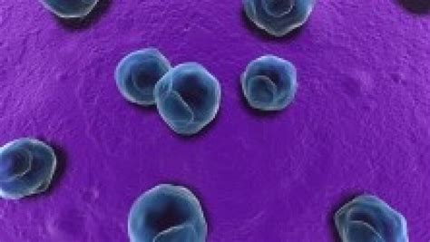 A Chlamydia fertőzés lehetséges szövődményei