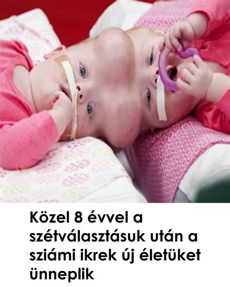 Ikrek a szülés után