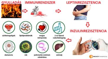Inzulinrezisztencia és meddőség diagram