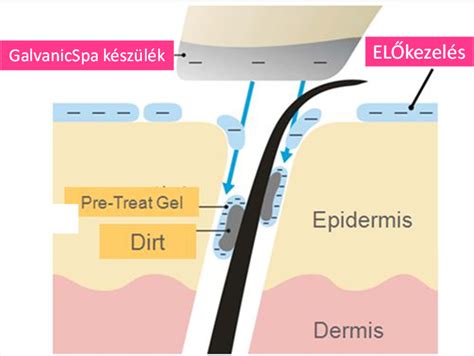 Ultrahang készülék működési elve