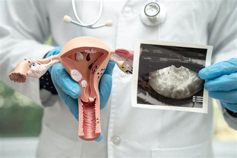 Ultrahang képek különböző nőgyógyászati elváltozásokról