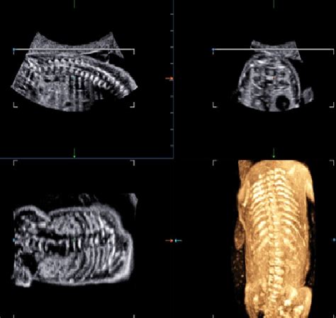 A magzati diagnosztika történetének kronológiája