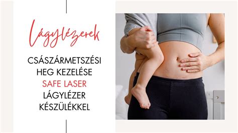 Fertőzött császármetszési heg