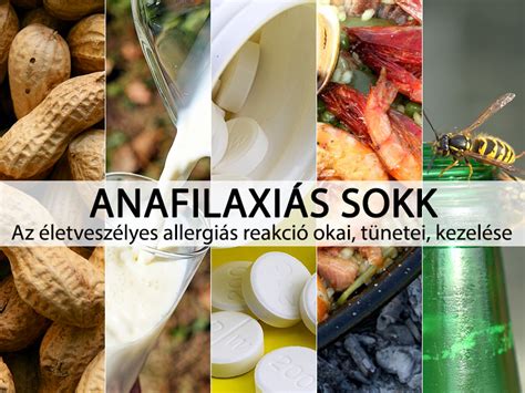 Anafilaxiás sokk kezelése