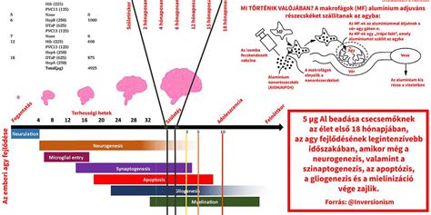 Agyfejlődési rendellenességek ultrahangon