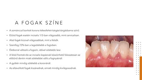 Fogak fluorozása