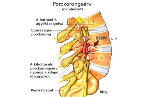 A gerinc szerkezetét és az epidurális tér elhelyezkedését bemutató anatómiai ábra