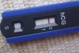 laboratóriumi vérvétel és hCG teszt