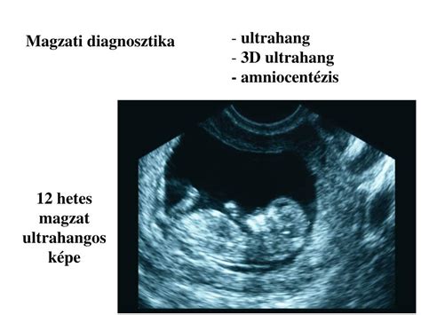 magzati szívfejlődés ultrahangos képe