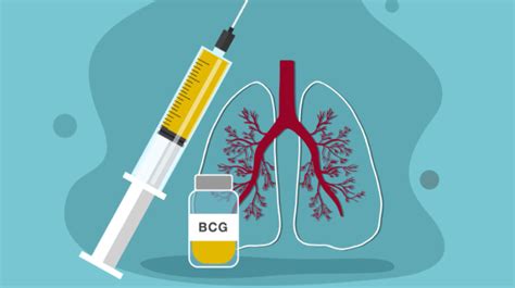 BCG oltás helye a vállon