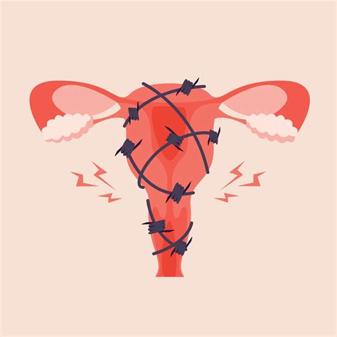 A vaginizmus magyarázata