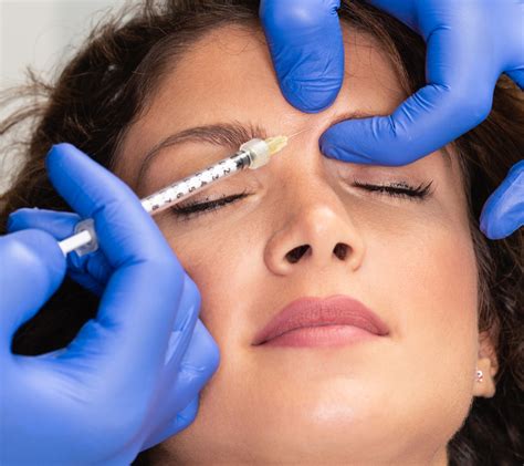 botox injekció hónaljba
