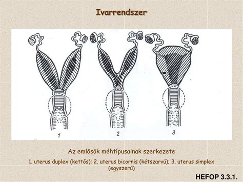 Kettős méh (Uterus didelphys) anatómiai ábrája