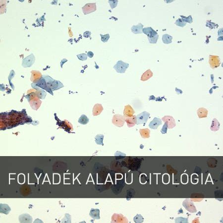 Folyadék alapú citológia mintavétel