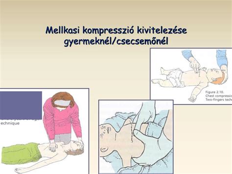 Mellkasi kompresszió csecsemőnél