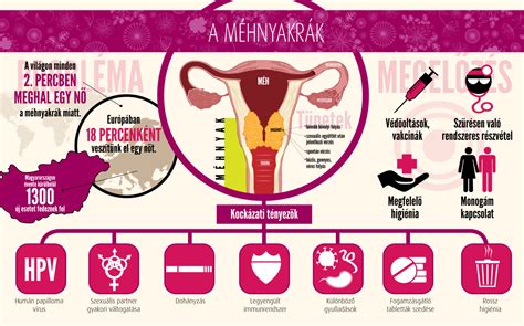 Emlőrák kockázati tényezői infografika