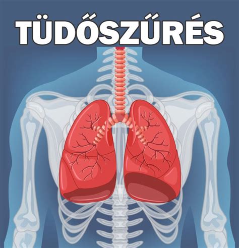 Tüdőszűrés folyamata