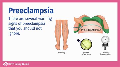 infografika a preeclampsia tüneteiről