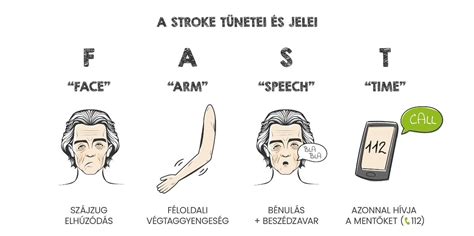 A gyermekeknél előforduló stroke tünetei