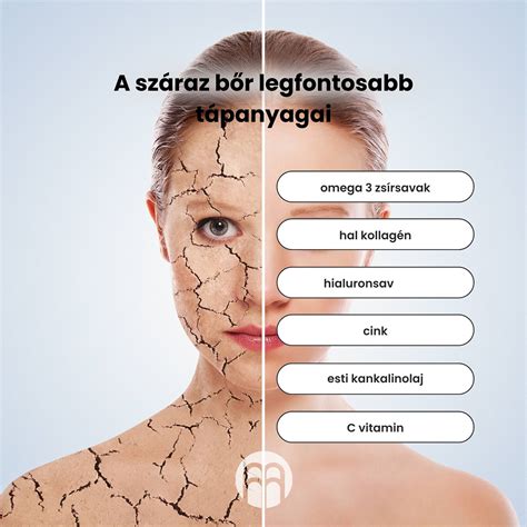 cserepes ajkak és száraz bőr bemutatása