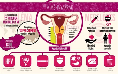 A konizáció menete és a méhnyak állapota
