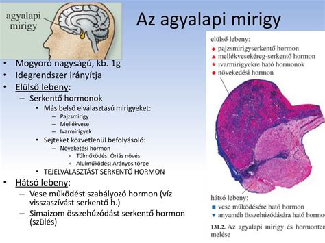 Agyalapi mirigy ábrája a prolaktinóma lokalizációjával