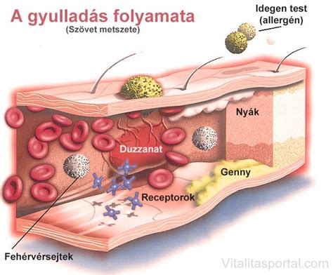 A fájdalom és gyulladás csökkentésének folyamata