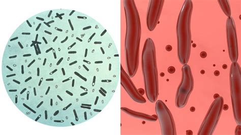A Clostridium botulinum baktérium életciklusa