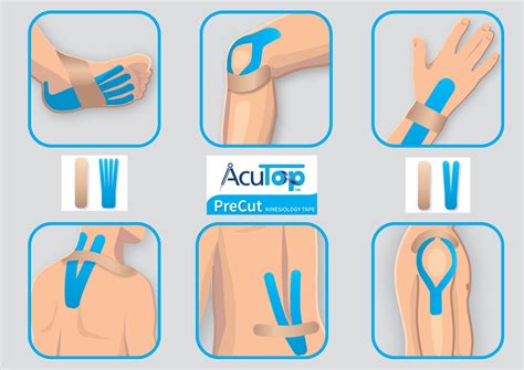 Kinesio tape felhelyezése mellgyulladás esetén