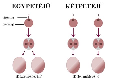 Az egypetéjű ikrek kialakulása és fejlődése