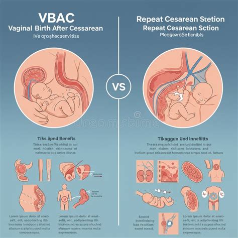 Diagram a VBAC sikert befolyásoló tényezőkről