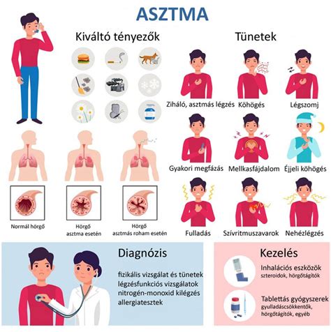 A koszmó kialakulásának okai infografika