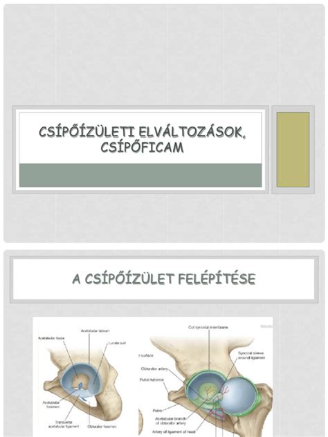 A csípőficam ultrahangos felismerése