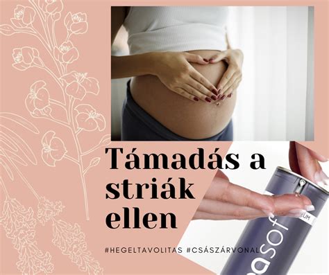A striák kialakulásának mechanizmusa