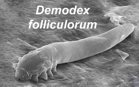 Demodex atka mikroszkopikus képe