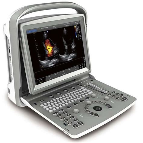 Ultrahang készülék és magzati kép